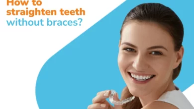 How to straighten teeth without braces